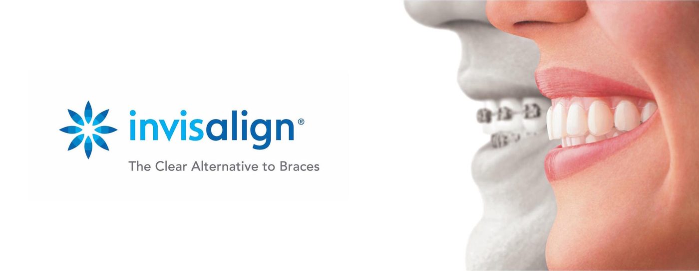 Clear aligner treatment